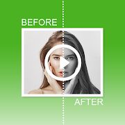 Скачать бесплатно Diff Before After До после видео коллаж из фото [Без рекламы] 1.0_b102 - Русская версия apk на Андроид